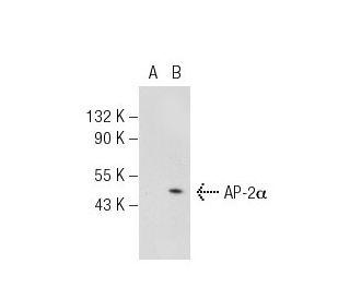 AP-2&alpha;/&beta; Antibody (3H547) - Western Blotting - Image 44828 