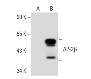 AP-2&beta; Antibody (1F3/8) - Western Blotting - Image 30149