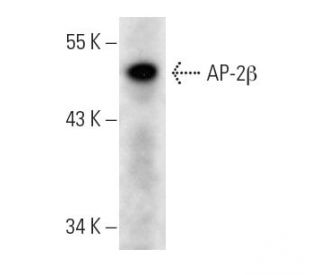 AP-2&beta; Antibody (1G6/2) - Western Blotting - Image 14270 