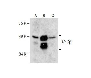 AP-2&beta; Antibody (G-7) - Western Blotting - Image 286894 