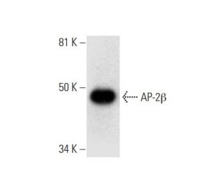 western blotting image from recommended AP-2β (C-6) monoclonal antibody replacement. Image 300084