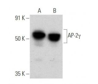 AP-2&gamma; Antibody (AP2g 6E4/4) - Western Blotting - Image 355240 