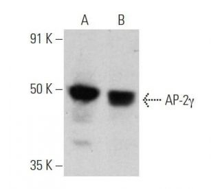 western blotting image from recommended AP-2&gamma; (6E4/4) monoclonal antibody replacement. Image 355246