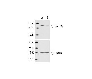 AP-2&gamma; siRNA (h): sc-29696. Western blot analysis of AP-2&gamma; expression in non-transfected control (A) and AP-2&g 