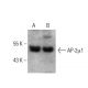 AP-2μ1 Antibody (E-7) - Western Blotting - Image 378396 