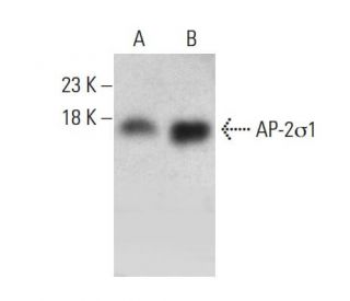 AP-2&sigma;1 Antibody (5-RY21) - Western Blotting - Image 384539 