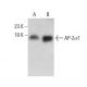 AP-2σ1 Antibody (5-RY21) - Western Blotting - Image 384539 