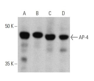 western blotting image from recommended AP-4 (A-8) monoclonal antibody replacement. Image 359991