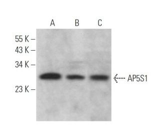 AP5S1 Antibody (E-4) - Western Blotting - Image 371931 