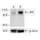 APC Antibody (ALi 12-28) - Western Blotting - Image 412581