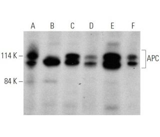 western blotting image from recommended APC (F-3) monoclonal antibody replacement. Image 366650