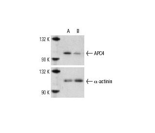 APC4 siRNA (h): sc-29704. Western blot analysis of APC4 expression in non-transfected control (A) and APC4 siRNA transfect 