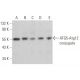 This polyclonal antibody has been discontinued. See our recommended <a href="atg5-antibody-c-1">APG5/ATG5 (C-1)</a> monoclonal antibody (sample data shown). western blotting image from recommended APG5/ATG5 (C-1) monoclonal antibody replacement. Image 352054