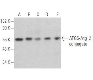western blotting image from recommended APG5/ATG5 (C-1) monoclonal antibody replacement. Image 352054
