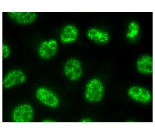 hichitto様 api5-antibody-e-12-western-