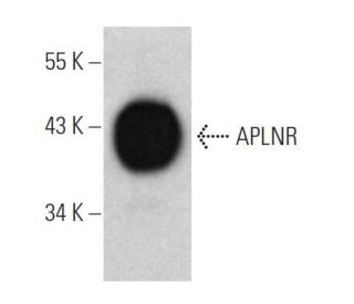 APLNR Antibody (3C3-7) - Western Blotting - Image 374608SAM Transcription Activation: SAM system utilizing dCas9-VP64, MS2-P65-HSF1, and sgRNA for precise gene transcription activation.