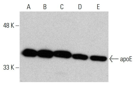 あーこ A Is For Atmos: adidas Originals A-ZX ZX 8000 | UP THERE