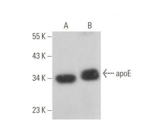 apolipoprotein E/apoE Antibody (WU E-4 ) - Western Blotting - Image 352742 