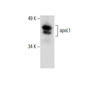apoL1 Antibody (A-3) - Western Blotting - Image 288504SAM Transcription Activation: SAM system utilizing dCas9-VP64, MS2-P65-HSF1, and sgRNA for precise gene transcription activation.