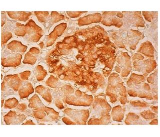 apoOL Antibody (G-6) - Immunohistochemistry - Image 304607 