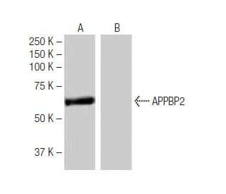APPBP2 Antibody (4-RE24) - Western Blotting - Image 64853