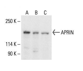 APRIN Antibody (F-9) - Western Blotting - Image 405002