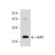 Aquaporin 0/AQP0 Antibody (B-11) - Western Blotting - Image 155559 
