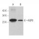 Aquaporin 0/AQP0 Antibody (B-11) - Western Blotting - Image 363973