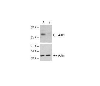 AQP1 siRNA (h): sc-29711. Western blot analysis of AQP1 expression in non-transfected control (A) and AQP1 siRNA transfect 