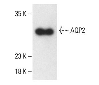 Aquaporin 2/AQP2 Antibody (E13-21) - Western Blotting - Image 401918