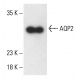 Aquaporin 2/AQP2 Antibody (E13-21) - Western Blotting - Image 401918