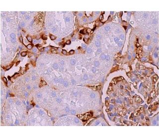 immunohistochemistry image from recommended Aquaporin 2/AQP2 (E-2) monoclonal antibody replacement. Image 368887