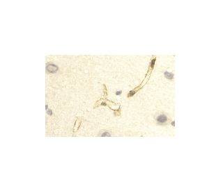 immunohistochemistry image from recommended Aquaporin 4/AQP4 (4/18) monoclonal antibody replacement. Image 11433