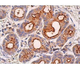 immunohistochemistry image from recommended Aquaporin 5/AQP5 (D-7) monoclonal antibody replacement. Image 370163