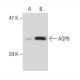 AQP8 Antibody (14-Z) - Western Blotting - Image 47018