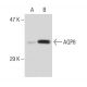 Aquaporin 8/AQP8 Antibody (14-Z) - Western Blotting - Image 47018