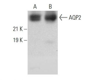 Aquaporin 2/AQP2 Antibody (G-3) - Western Blotting - Image 379033Each CRISPR/Cas9 Knockout (KO) Plasmid product consists of a pool of 3 plasmids designed to ensure identification and cleavage of a specific gene for maximum knockout efficiency. Each plasmid encodes a unique 20 nt sequence derived from the GeCKO (v2) library.