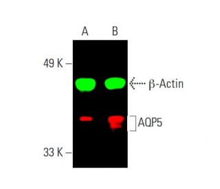 Aquaporin 5/AQP5 Antibody (D-7) - Western Blotting - Image 387704Each CRISPR/Cas9 Knockout (KO) Plasmid product consists of a pool of 3 plasmids designed to ensure identification and cleavage of a specific gene for maximum knockout efficiency. Each plasmid encodes a unique 20 nt sequence derived from the GeCKO (v2) library.