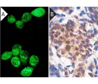 Androgen Receptor Antibody 441 SCBT Santa Cruz Biotechnology