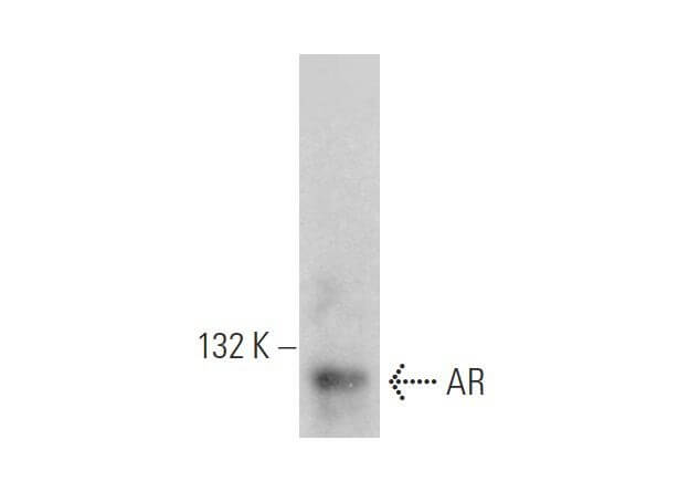Androgen Receptor Antibody (441) | SCBT - Santa Cruz Biotechnology