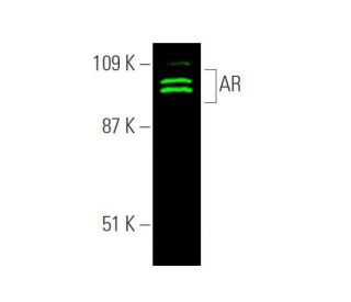 Androgen Receptor Antibody 441 SCBT Santa Cruz Biotechnology