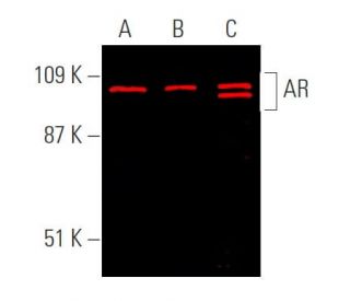 Androgen Receptor Antibody 441 SCBT Santa Cruz Biotechnology