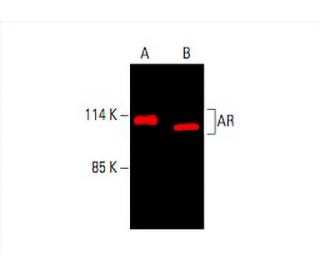 AR/Androgen Receptor Antibody (441) - Western Blotting - Image 394021 