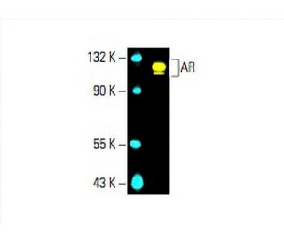 Androgen Receptor Antibody 441 SCBT Santa Cruz Biotechnology