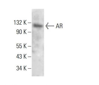 Androgen Receptor Antibody (AN1-15) - Western Blotting - Image 380820
