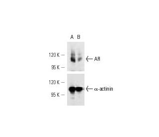 AR siRNA (h): sc-29204. Western blot analysis of AR expression in non-transfected control (A) and AR siRNA transfected (B) 