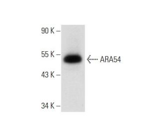 ARA54 Antibody (B-10): sc-376701