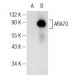 ARA70 Antibody (C-4) - Western Blotting - Image 146574 