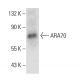 ARA70 Antibody (C-4) - Western Blotting - Image 387373