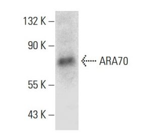 ARA70 Antibody (C-4) - Western Blotting - Image 387373The Double Nickase Plasmid features a U6 promoter for sgRNA expression, a 20 nt targeting sequence, and a gRNA scaffold to guide Cas9n. It includes a CBh promoter for Cas9n (D10A) and puromycin resistance, GFP for transfection verification, and nuclear localization signals (NLS). The 2A peptide allows co-expression of Cas9n and Puro from a single promoter, enabling precise genome editing with reduced off-target effects. 